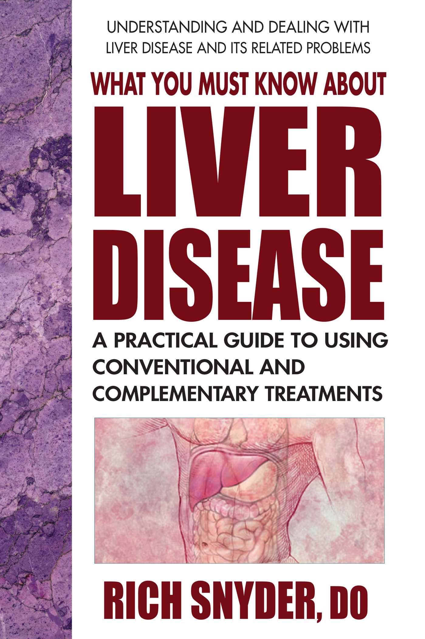 What You Must Know About Liver Disease