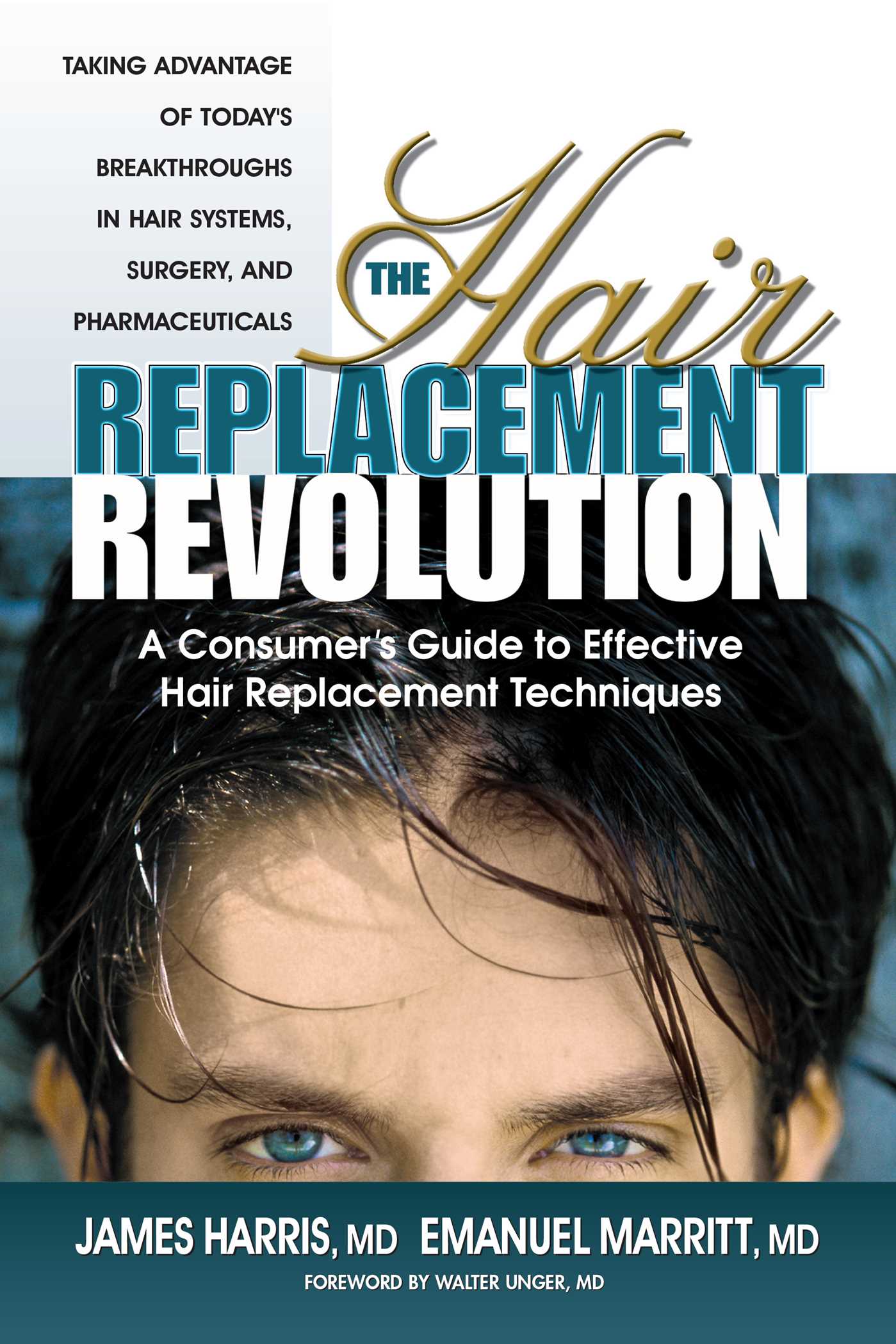 Hair Replacement Revolution: A Consumer's Guide to Effective Hair Replacement Techniques